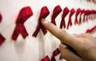 На Хмельниччині епідситуація з ВІЛ-інфекції/СНІДу залишається напруженою