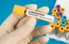 Симчишин: хмельницький бізнес закупить 1000 тестів на коронавірус
