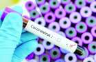 Коронавірус: Хмельниччина передбачила 28 млн грн на випадок введення надзвичайного стану – Габінет