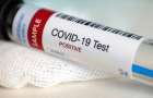 На Хмельниччині визначено 20 лабораторій для проведення ІФА-тестувань на коронавірус – ОДА