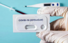 Новий антирекорд на Хмельниччині: за день виявлено 125 хворих на коронавірус
