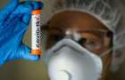 На Хмельниччині за 7 місяців від коронавірусу померло 22 людини – облстат