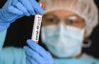 На Хмельниччині за добу зафіксовано 427 осіб з діагнозом коронавірус і сім летальних випадків