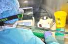 “Коронавірусний” рекорд – за добу на Хмельниччині виявлено понад 700 хворих