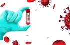 “Коронавірусні” аномалії: в області за добу виявлено лише 7 хворих