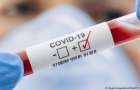 На Хмельниччині за добу зареєстрували 35 нових випадків COVID-19