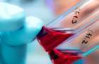За чотири місяці 2023 року на Хмельниччині від СНІДу померло 14 людей