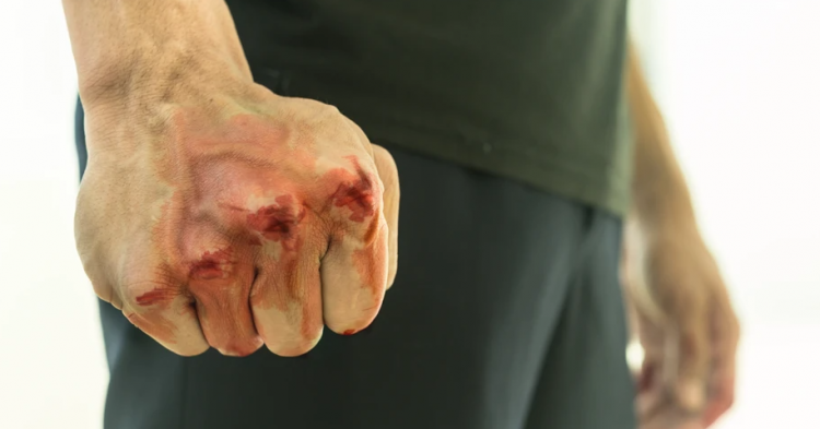 У Хмельницькому побили військовослужбовця: поліція відкрила провадження