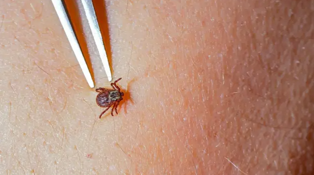 Хвороба Лайма дала про себе знати через пів року: історія жительки Хмельниччини