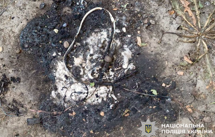 На Хмельниччині 11-річний хлопчик травмувався через вибух невідомого предмета