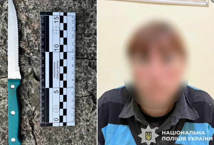 На Хмельниччині 37-річна жінка після застілля вдарила знайому ножем у живіт